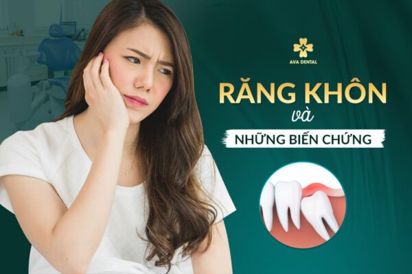 rang-khon