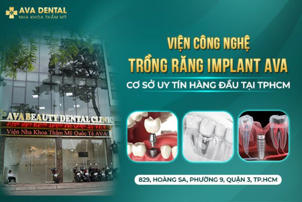 vien-cong-nghe-trong-rang-implant-ava-dental